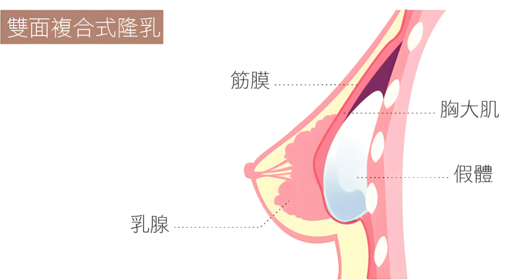 复合隆胸前后效果对比图