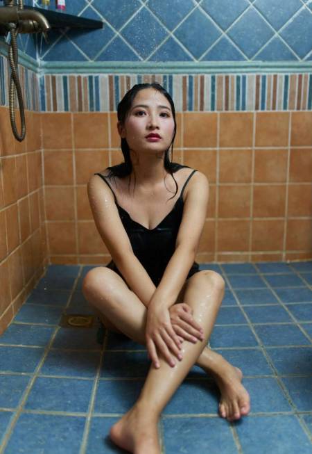 在杭州格莱美做了吸脂瘦全身手术后100天