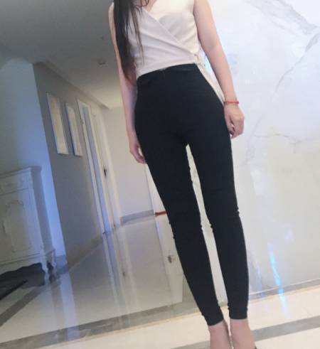 成都中科美美给我做的吸脂瘦大腿手术后2个月
