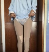广州晨曦美容医院陈柯怎么样？相关医生信息~附吸脂瘦大腿手术案例分享！