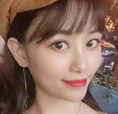 在南方医科大学珠江整形医院做的自体脂肪面部填充手术后45天