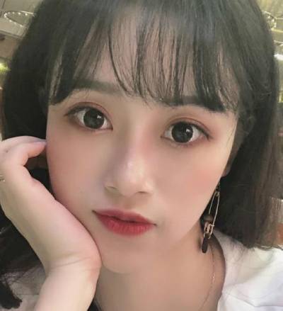 在南方医科大学珠江整形医院做的自体脂肪面部填充手术后2个月