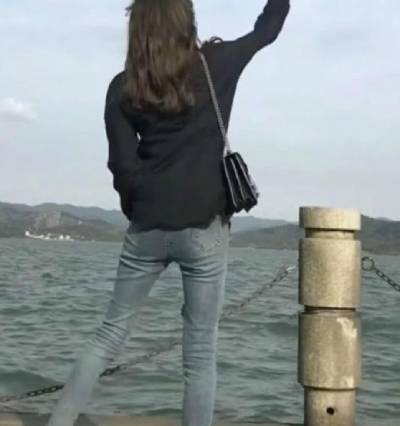 郑州辰星于鑫医生为我做吸脂瘦大腿手术后60天