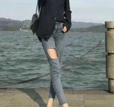 郑州辰星于鑫医生为我做吸脂瘦大腿手术后90天