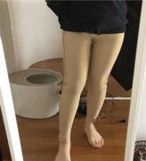 郑州梨花雨医院徐刚强怎么样？医生信息一览表 附徐医生吸脂手术个人案例分