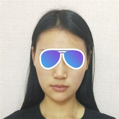 北医三院李东隆鼻怎么样?自体脂肪面部填充三个月术前术后图-价格表更新