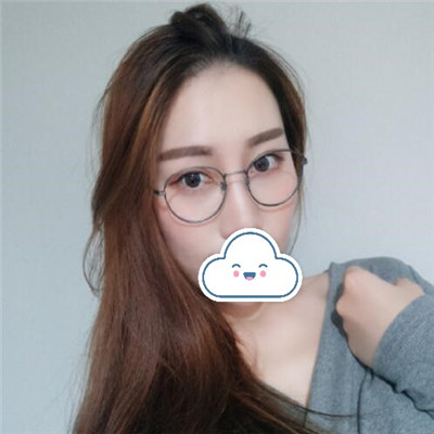 北京华韩柳民熙面部提升做得好吗?自体脂肪填充三个月术前术后图-价格表