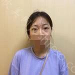 长春汇美国际整形医院到底怎么样?内附案例分享+2021较新价格表