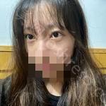 长春汇美国际整形医院到底怎么样?内附案例分享+2021较新价格表