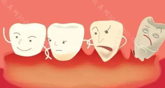 牙周病有什么拯救措施，它是无法治愈吗？