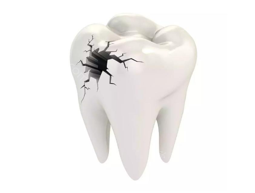 为什么说牙周炎要重在预防，治疗痊愈很难？