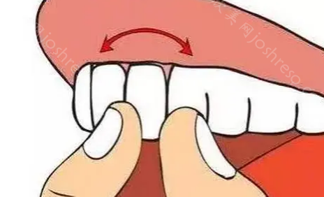 牙齿松动的原因有哪些？