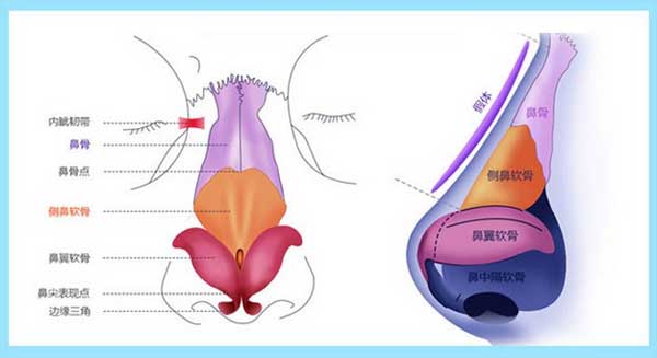 鼻中隔软骨隆鼻有哪些注意事项