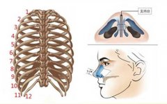 自体肋软骨隆鼻会吸收多少