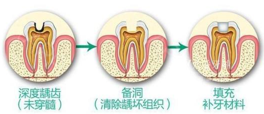 上海九院补牙需要多少钱 附上年九院口腔科价目表 欣美整形 上海九院补牙需要多少钱 附上年九院口腔科价目表 欣美整形