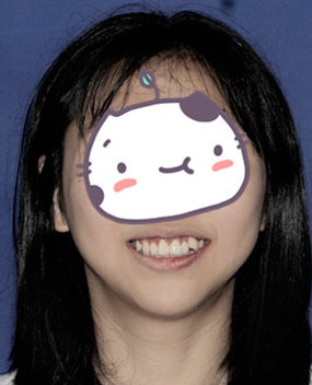 上海牙齿矫正医院哪里比较好呢,如何选择靠谱的牙科医生？