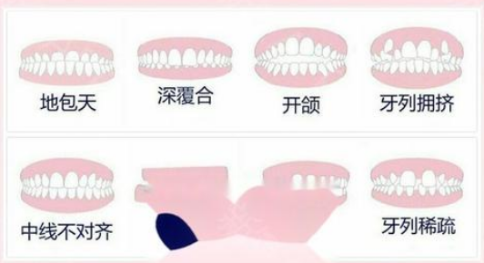 上海牙齿矫正医院哪里比较好呢,如何选择靠谱的牙科医生？
