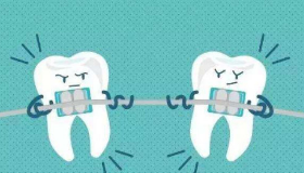 牙齿矫正真的会导致牙齿松动吗?不，这才是真相