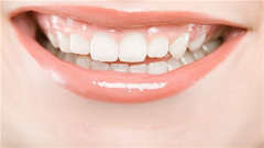 牙齿反颌矫正手术的价格及具体影响因素