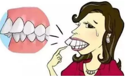 32岁的你有这几大症状还不整牙?等着后悔一辈子吗?