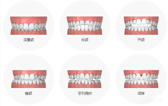 标准的牙齿咬合图片