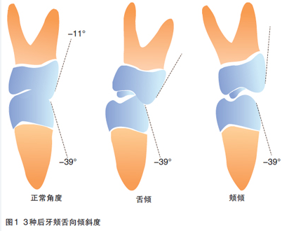 标准的牙齿咬合图片