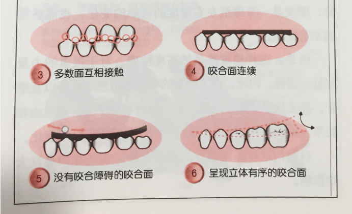 标准的牙齿咬合图片