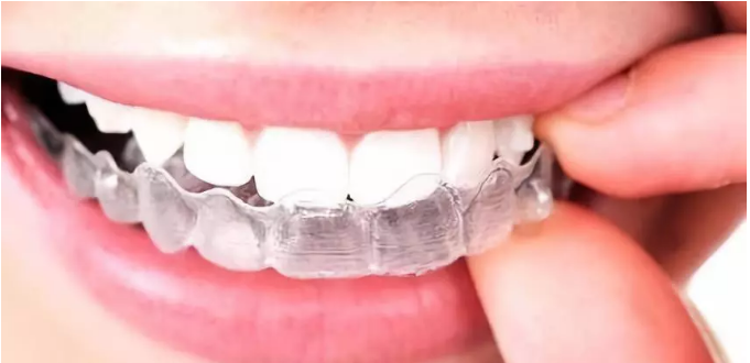 如何预防牙套脸