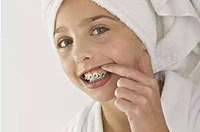 儿童牙齿矫正需要多少钱和时间