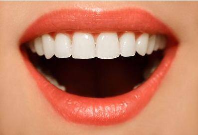 上海牙齿矫正#做牙齿矫正的费用大概是多少?