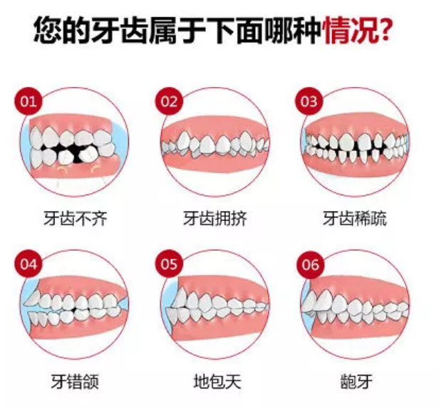 牙齿矫正需要多久