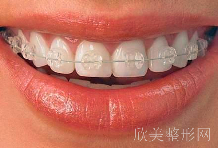 戴牙套后突发“牙龈萎缩”怎么办?