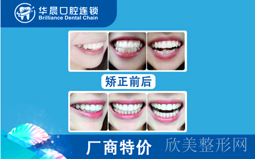 广州白云区牙齿矫正哪里比较好