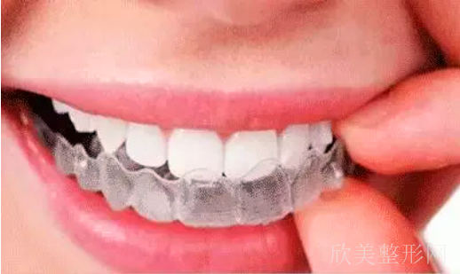 牙齿矫正带隐形牙套多少钱