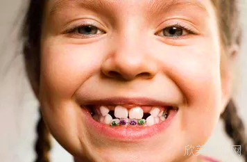 多大年龄不能矫正牙齿?正畸有没有年龄限制?