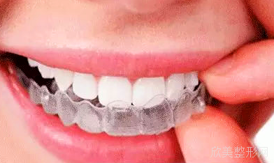 牙齿正畸后如何佩戴保持器?