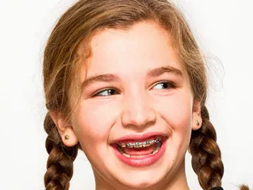 儿童矫正牙齿的较佳年龄及注意事项