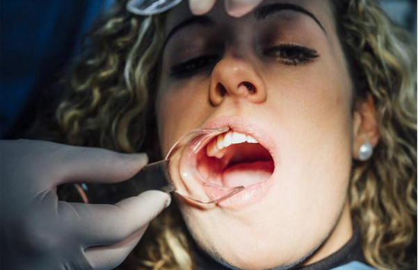 青少年牙齿矫正的后遗症和危害