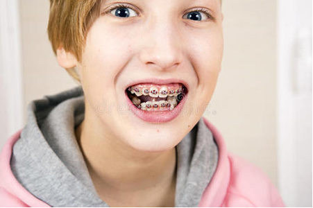 青少年牙齿矫正的后遗症是什么