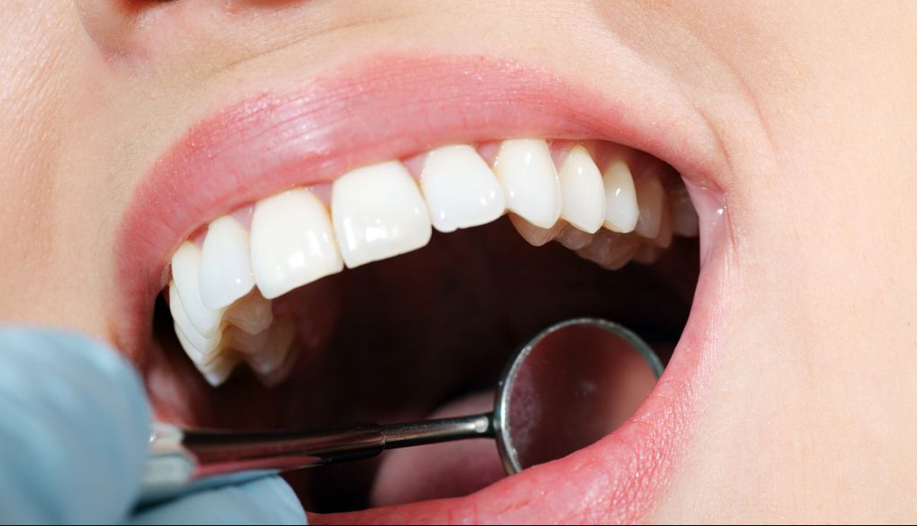 成人牙齿矫正后遗症和危害