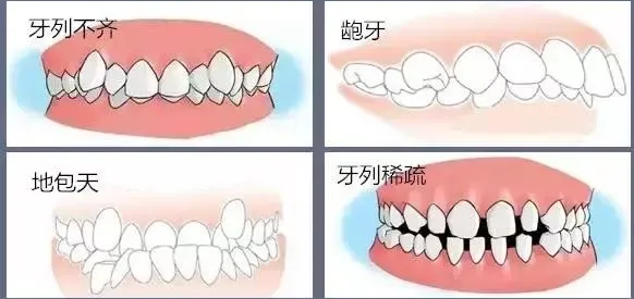 儿童牙齿矫正的较佳年龄是几岁?