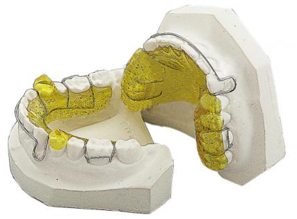 哈尔滨牙齿正畸的几种方法