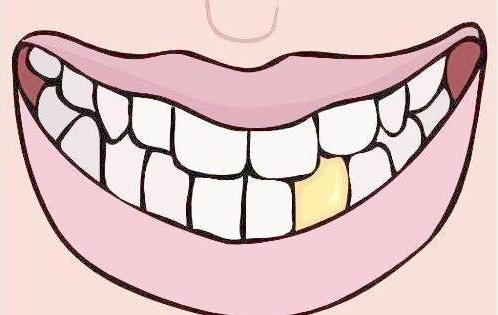 30岁整牙齿会不会容易掉