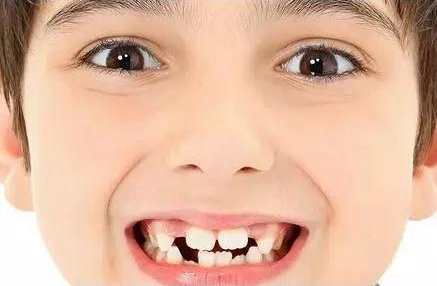 孩子牙齿矫正的*佳年龄