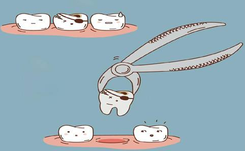 牙齿矫正的步骤有哪些