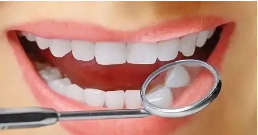 哪些牙齿需要做牙齿美白?