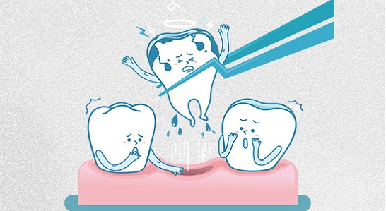 牙齿矫正拔牙对孩子有影响吗