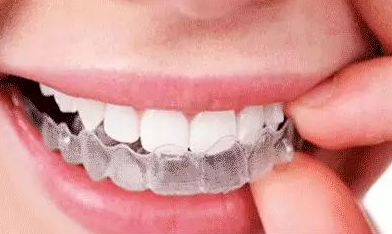 80%的牙齿矫正患者因为这个环节较终失败!