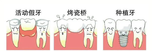牙齿缺失，有什么方法补救吗?