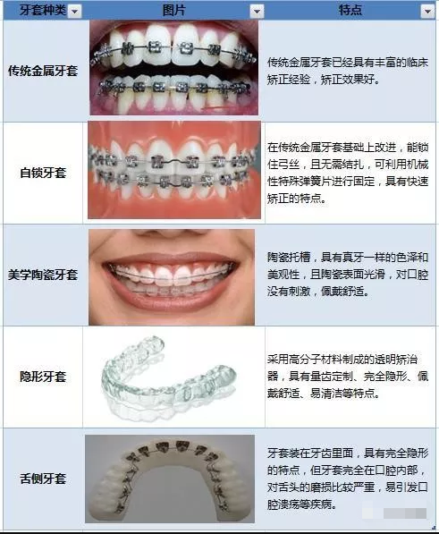 请问戴牙套的价格大致是多少